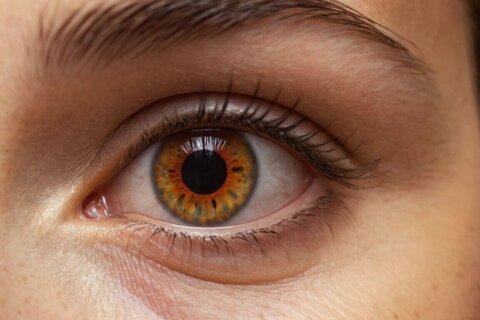 Schwarze Flecken sehen: Ein Warnsignal für Schlaganfall?